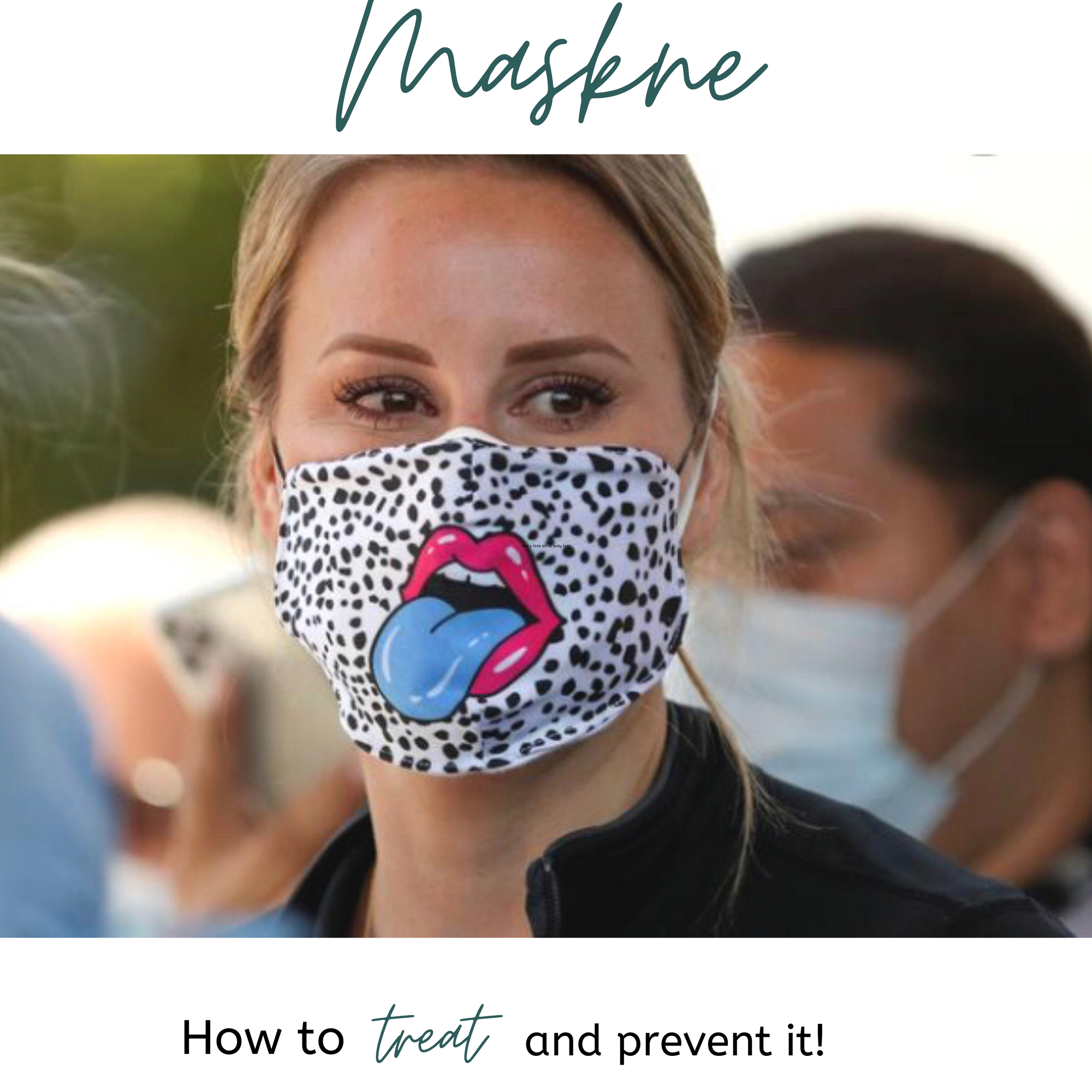 Maskne: How to treat and prevent  it!